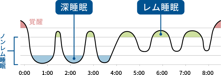 グラフ